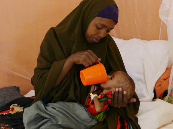 Undernärt barn får mat på en barnklinik