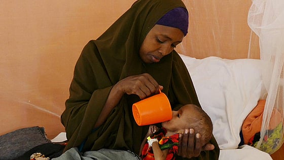 Undernärt barn får mat på en barnklinik