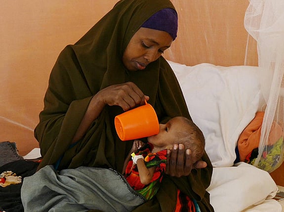 Undernärt barn får mat på en barnklinik