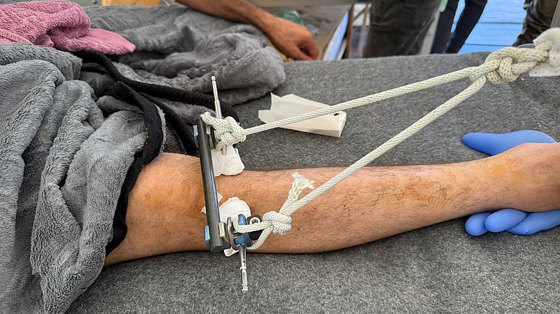 Vård på fältsjukhuset.